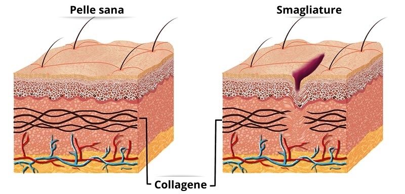 Pelle sana - Collagene