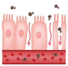 Mucosa intestinale lesa