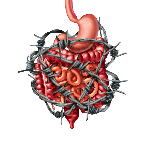 Ricorri alla soluzione Gut Restore