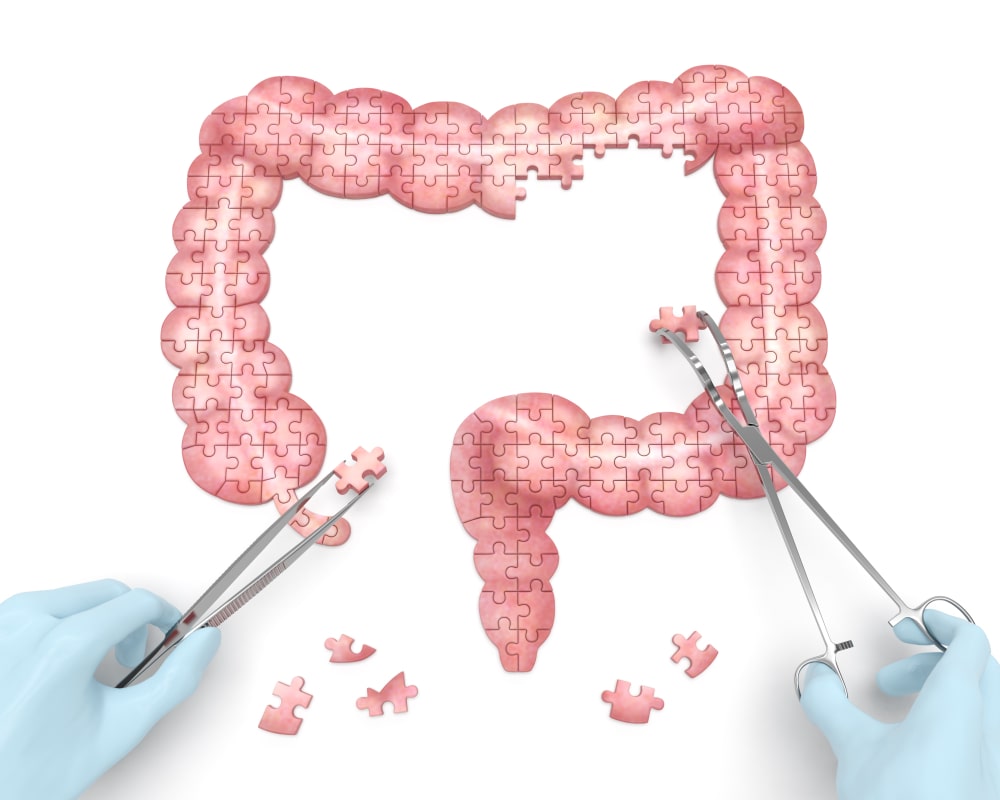 L’effetto del glutine sulla parete intestinale